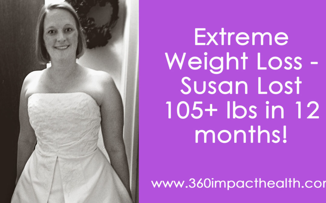 Extreme Weight Loss – She Lost Over 105 Lbs!